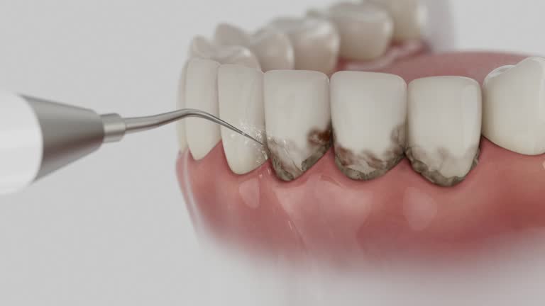 Reliable Dental Implants contractor in Appleton, WI by Smile Center Dentistry